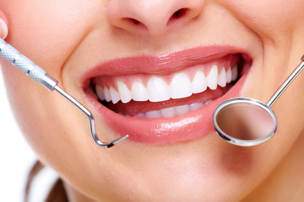 Teeth Whitening at AmericanSmile Dental